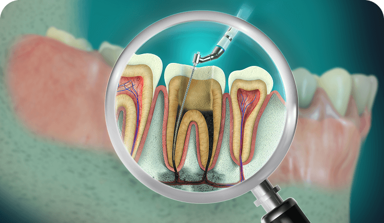 Tooth anatomy with root canal