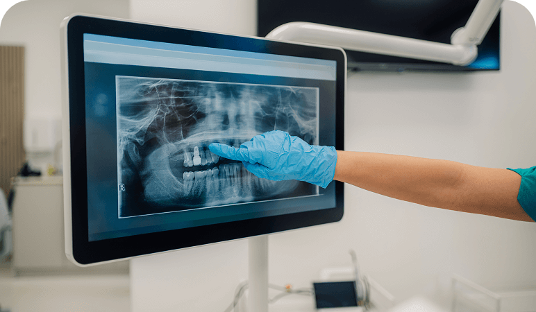 Dentist pointing at dental X-ray display