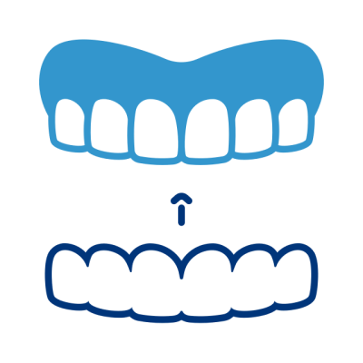 Invisalign
