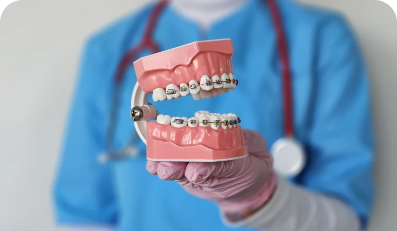 Dental model with braces in hand